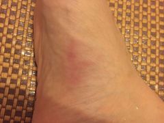 -智慧盲人按摩艾灸-颈肩腰膝疼痛调理(浦东店)