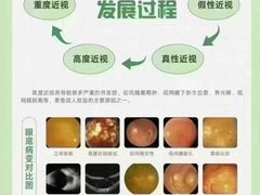 -宝视达眼镜(公园道店)