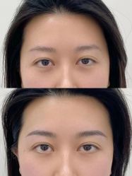 点击看大图 -张小野·专业半永久纹眉