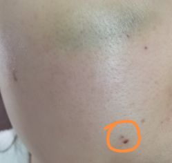 体验后-上海玫瑰医疗美容医院