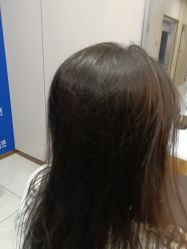 -碧莲盛不剃发植发