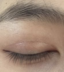 体验后-上海时光整形外科医院