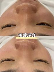 -美肤盾祛痘·问题肌头疗管理中心