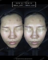 -E.beauty驻颜·痘敏肌调理中心