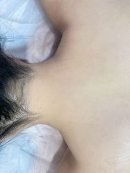 点击看大图 -小梨·OndaPro·专业脱毛连锁机构