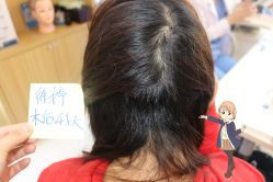 -大麦微针植发丨全国连锁