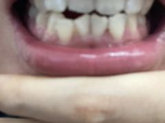 -微笑牙科口腔(三亚迎宾院区)
