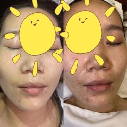 -苗方清颜痘肌研究所