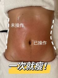 -Fundi张玉珊修身堂·indiba·BTL科技瘦身