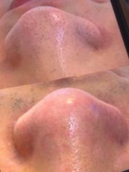 -skin79皮肤管理中心