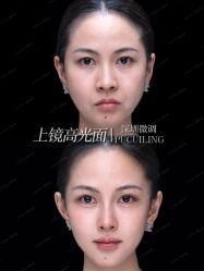 -深圳艺星医疗美容医院