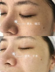 -SKIN79皮肤管理中心