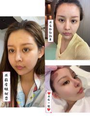 -天津时光诺颜·轻医美·轮廓抗衰中心