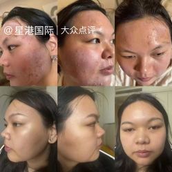 -星港国际·Skin皮肤专研·皮肤管理