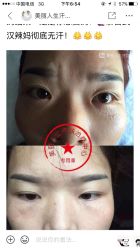 -美丽人生祛斑扁平疣汗管瘤中心
