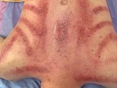 -郑师傅祖传推拿安波路(安波路200弄小区店)