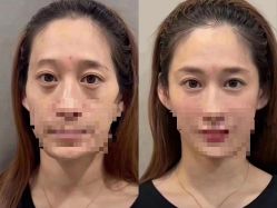 -丰联丽格医疗美容·联合丽格眼整形中心