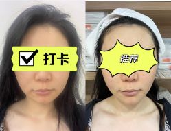 -More摩尔医美の注射线雕光电中心