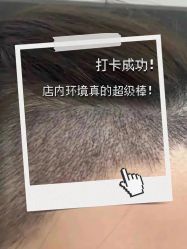 -大麦微针植发丨全国连锁