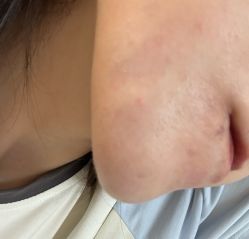 -美莱医疗美容医院