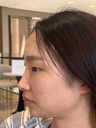 -四川米兰柏羽医学美容医院