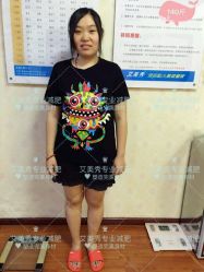 -维纳斯专业减肥