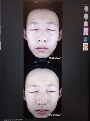 -和颜一美轻医美连锁