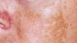 -北京米扬丽格医疗美容·联合丽格鼻整形中心