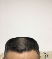 -金板寸