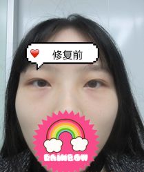 -素美医疗美容·西南眼鼻整形·修复基地