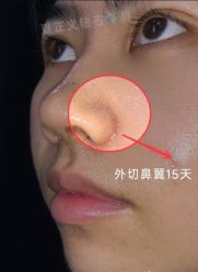 -北京米扬丽格医疗美容·联合丽格鼻整形中心