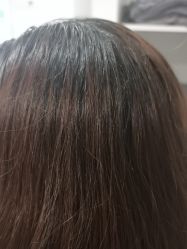 -熙朵美学植发·连锁品牌