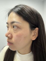 -长沙雅美医疗美容医院