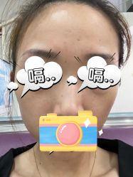 体验前-美莱医疗美容医院