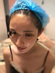 -惠妍美医美整形