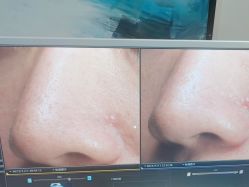 -苑苑vbeauty科技美容SPA
