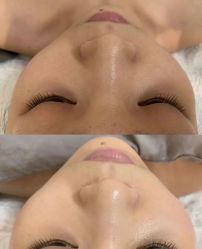 -上海伊莱美医疗美容医院