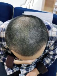 点击看大图 -熙朵美学植发连锁