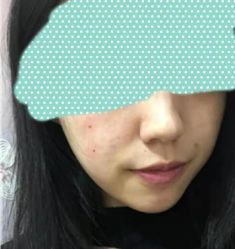 -洁铭新加坡医美