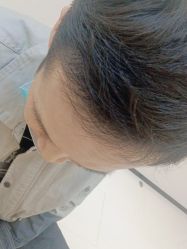 -雍禾植发全国连锁