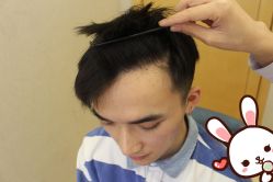 点击看大图 -大麦微针植发丨全国连锁