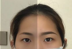 -丽美妍医疗美容·皮秒·立体分层抗衰