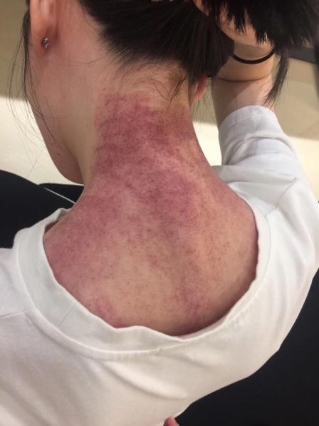 这次换了个小姐姐,感觉没有上次那个好按摩因为我怕痒并没有怎么按