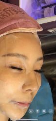 -新美荟医美·专注面部美学抗衰