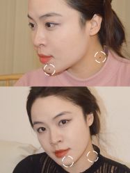 -清疣美疣·痣·斑净肤中心