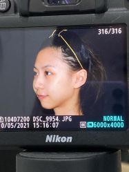 -慕颜医疗美容·皮肤微整 抗衰