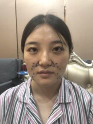 -洁铭新加坡医美