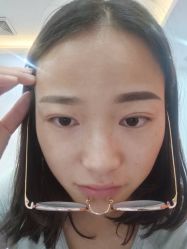 体验前-深圳美莱医疗美容医院