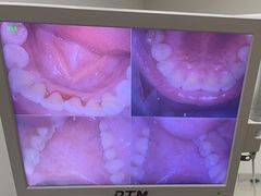 -土豆口腔(凤凰北总店)