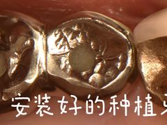 -精德口腔·种植修复·儿牙中心(财富中心店)